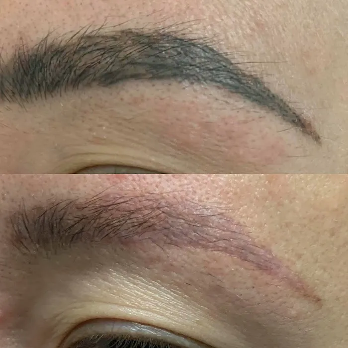 Microblading Clinic (Autumn Lee Artistry, Microblading Artist) 0
