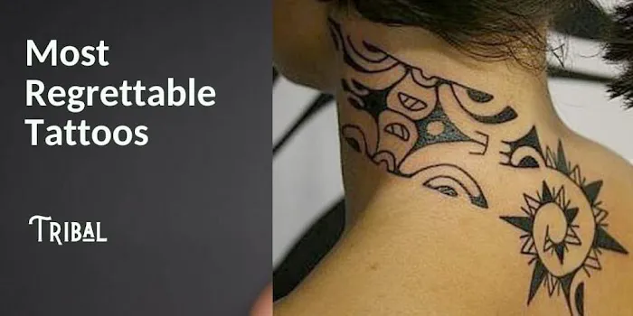 Northshore Tattoo Removal 2