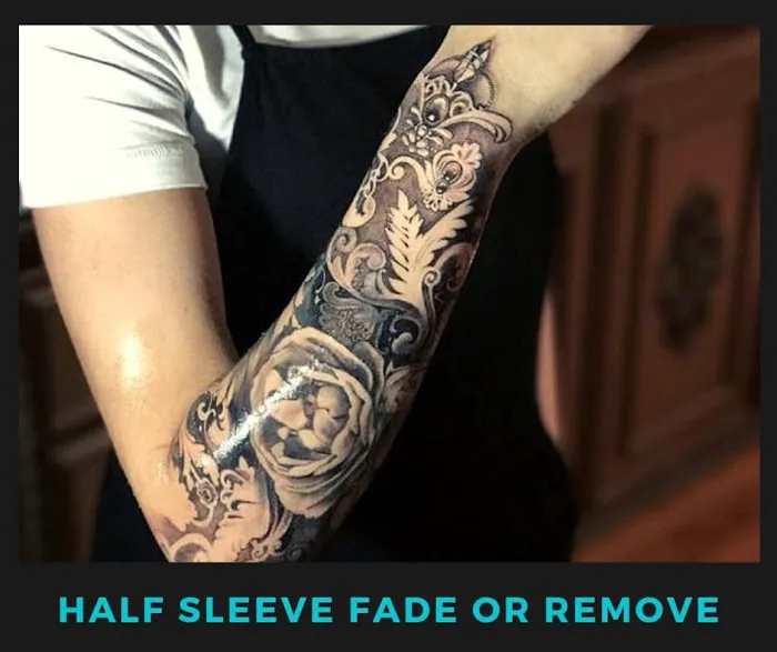 Northshore Tattoo Removal 1