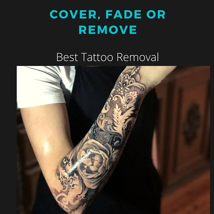 Northshore Tattoo Removal 9