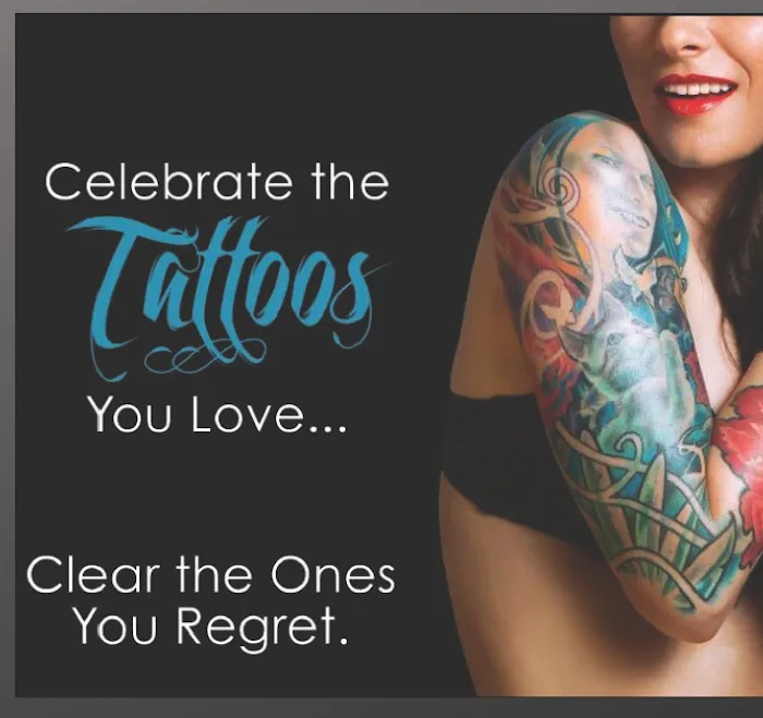 Northshore Tattoo Removal 5