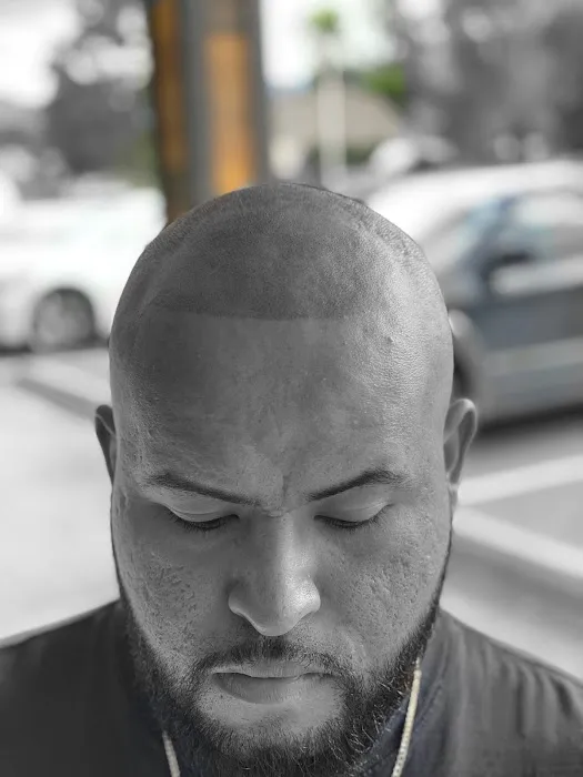 Scalp Therapy Micropigmentation 5