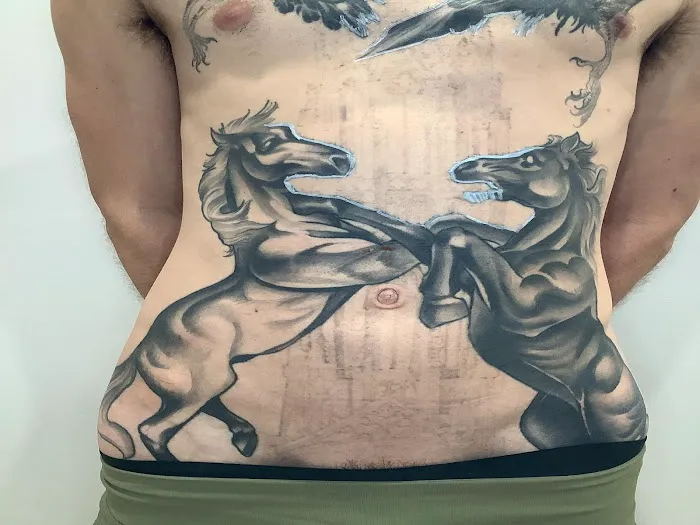 Removery Tattoo Removal & Fading 4