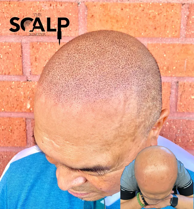 The Scalp Master 5