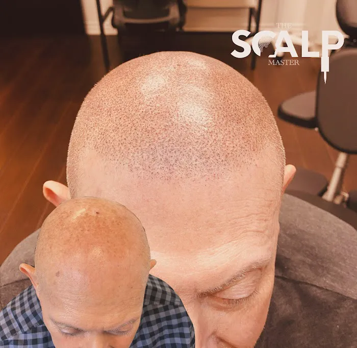 The Scalp Master 4