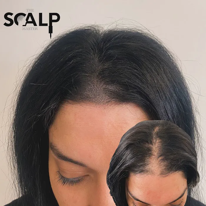 The Scalp Master 2