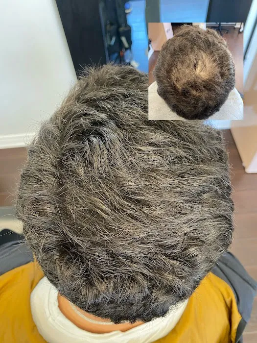 The Scalp Master 3