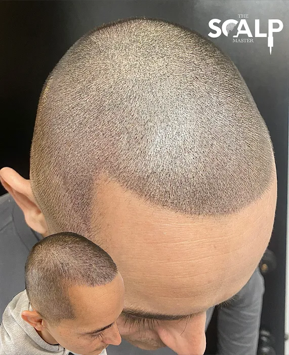 The Scalp Master 8
