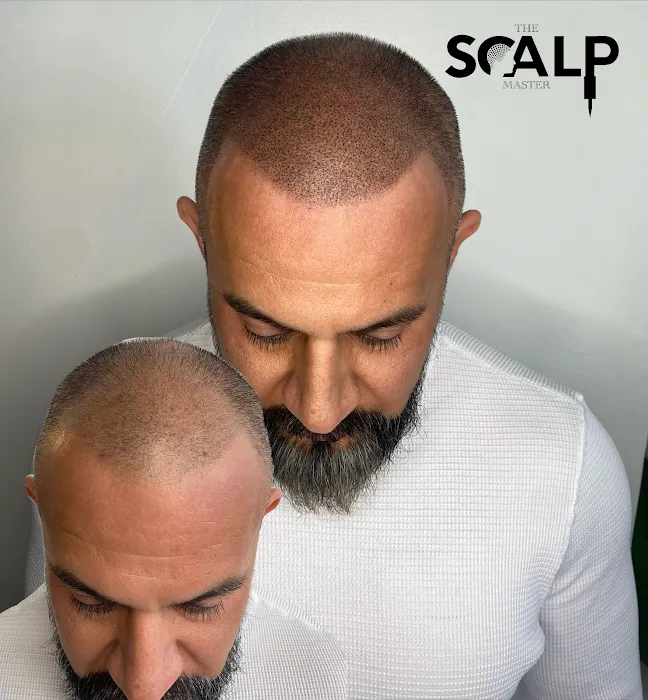 The Scalp Master 9