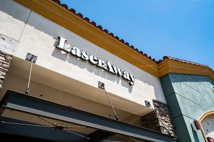 LaserAway Valencia 0