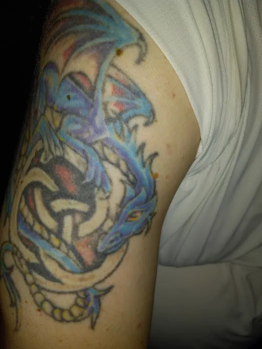 Removery Tattoo Removal & Fading 0