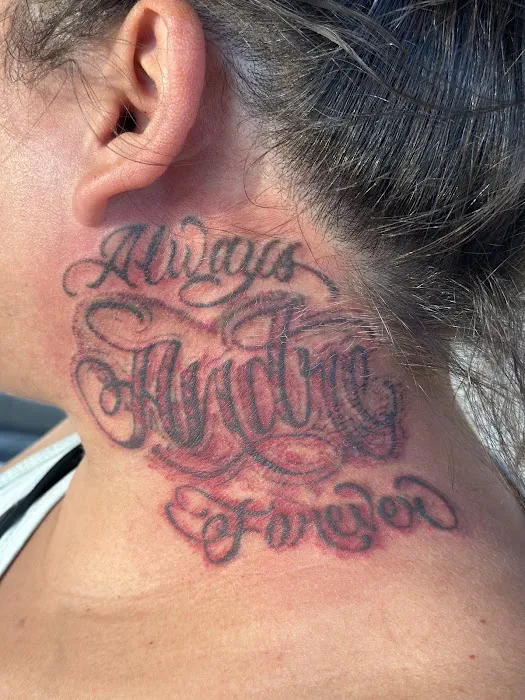 Removery Tattoo Removal & Fading 1