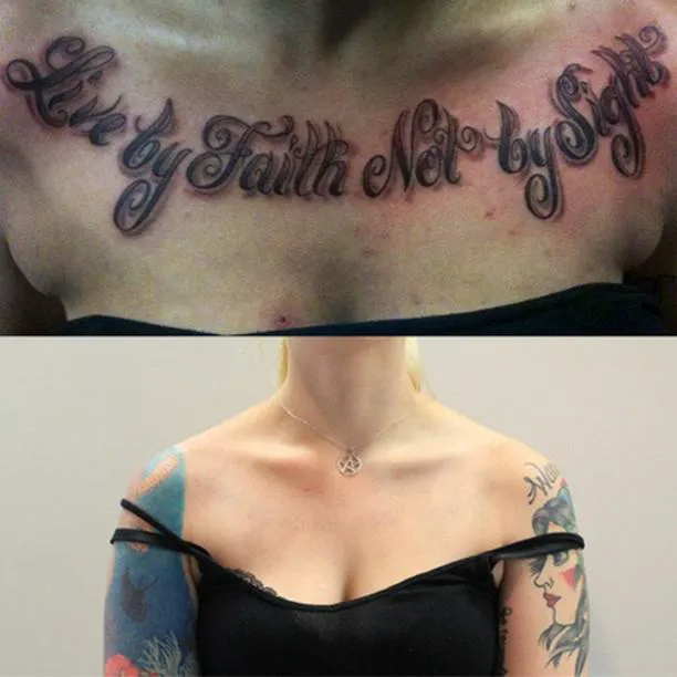 Removery Tattoo Removal & Fading 2