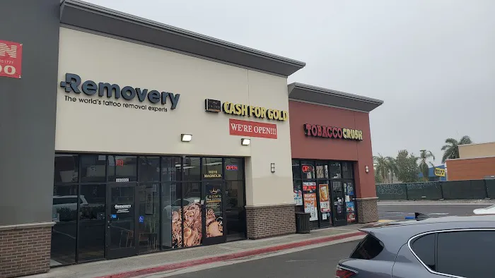 Removery Tattoo Removal & Fading 0