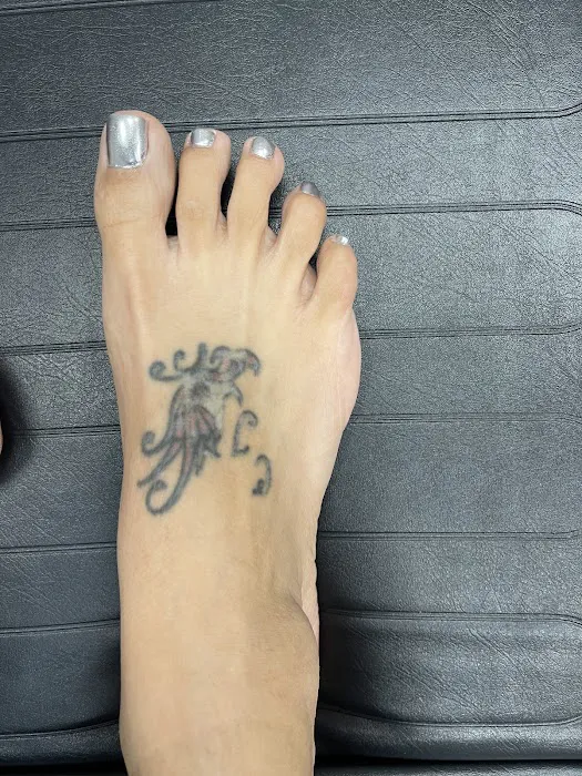 Removery Tattoo Removal & Fading 2