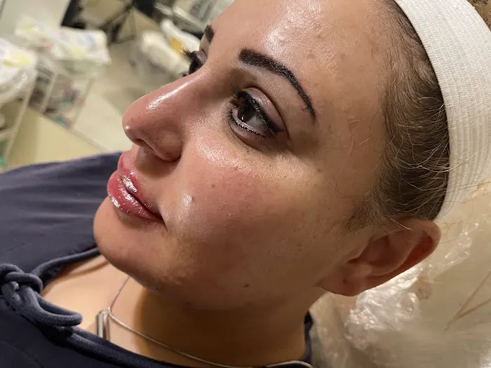 Goawaytats tattoo removal 8