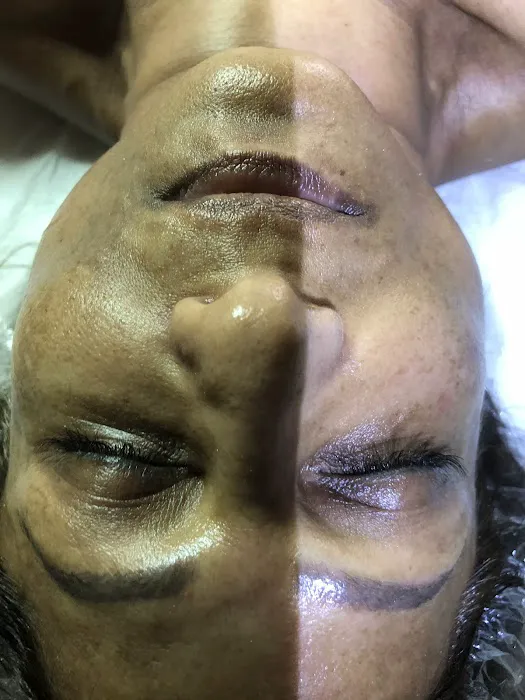 Goawaytats tattoo removal 2