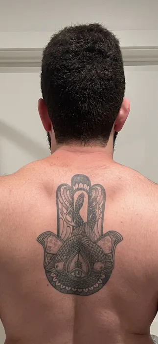 Removery Tattoo Removal & Fading 2