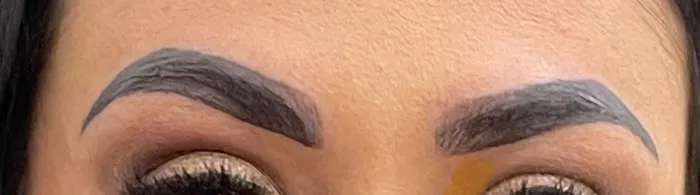 Removery Tattoo Removal & Fading 0