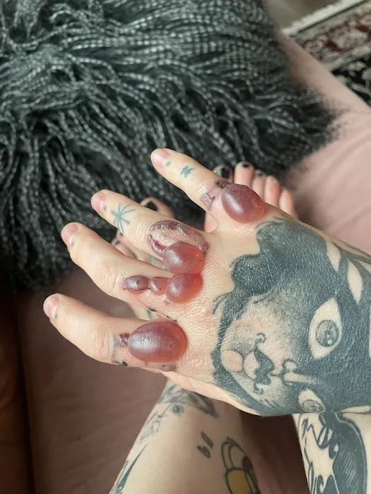 The UnTattoo Parlor 3