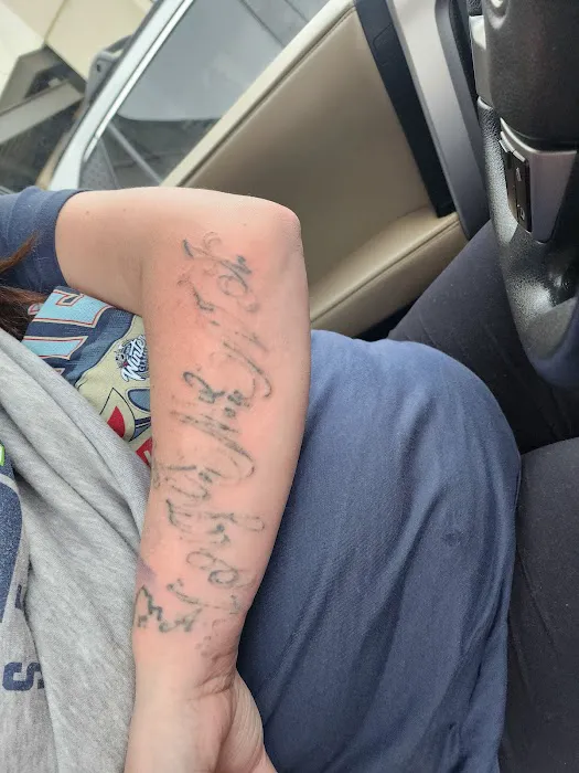 Removery Tattoo Removal & Fading 2