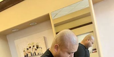 Arizona Scalp Micropigmentation - Scalp Wizards