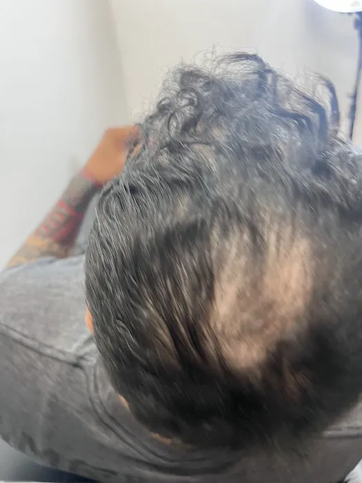 Arizona Scalp Micropigmentation - Scalp Wizards 7
