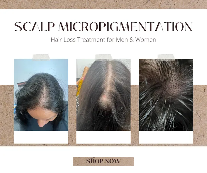 Arizona Scalp Micropigmentation - Scalp Wizards 3