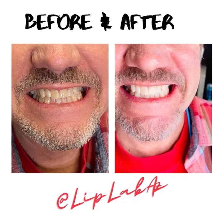 Lip Lab AZ 8