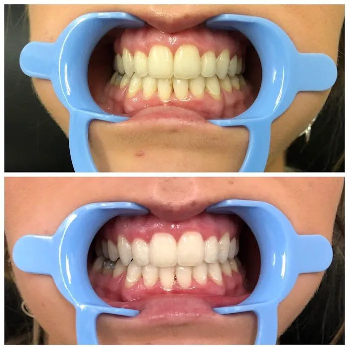 Lip Lab AZ 9