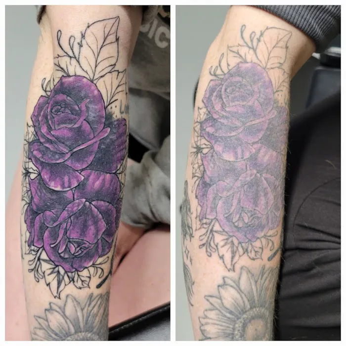 Black Out Tattoo Removal 1