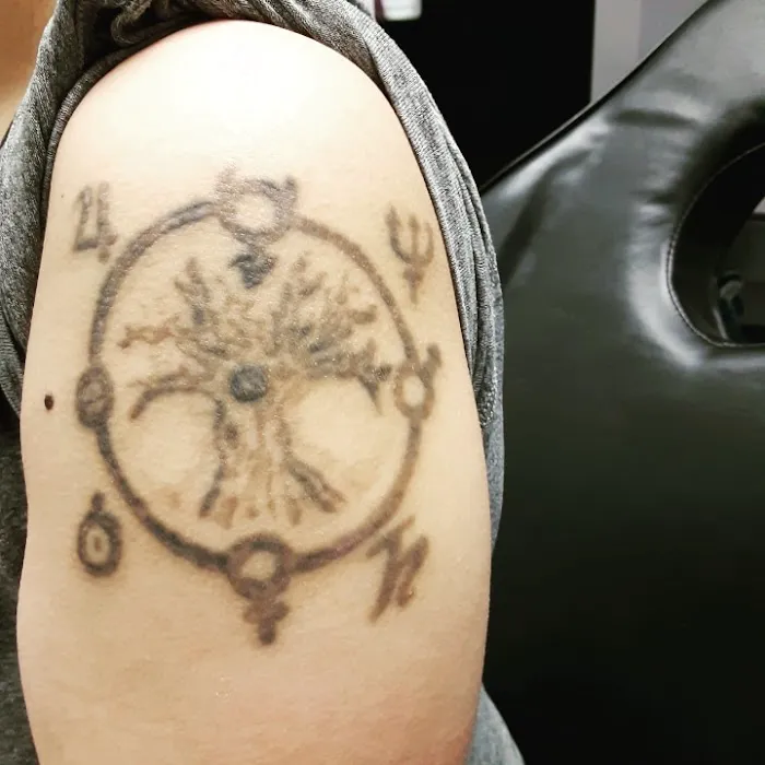 Fearless Tattoo Removal 4