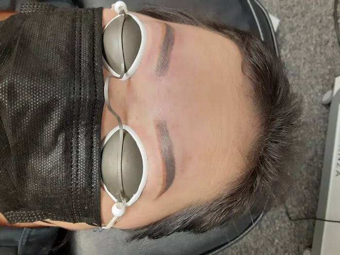 Fearless Tattoo Removal 0