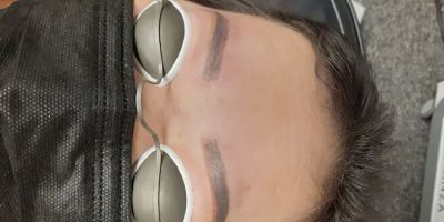 Fearless Tattoo Removal