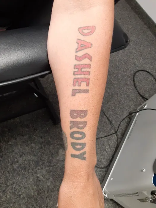 Fearless Tattoo Removal 2