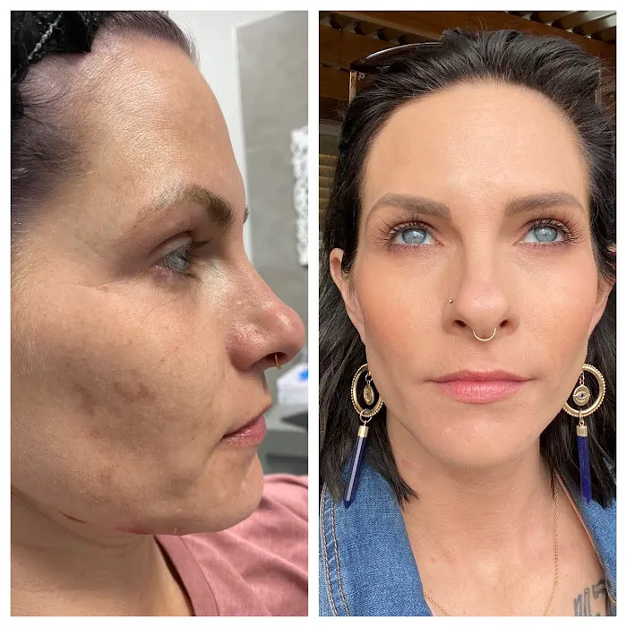 Medical Tattoo & Cosmetic Centers of America 6