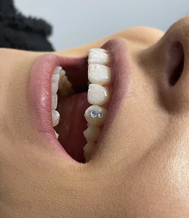 Medical Tattoo & Cosmetic Centers of America 8