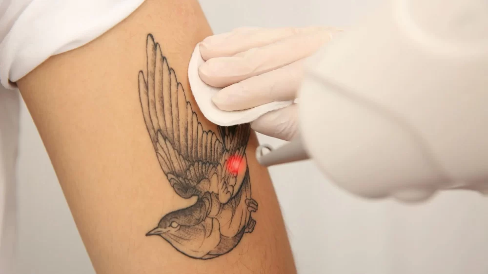 Effective Ways to Manage Post-Tattoo Swelling and Discomfort for Faster Healing